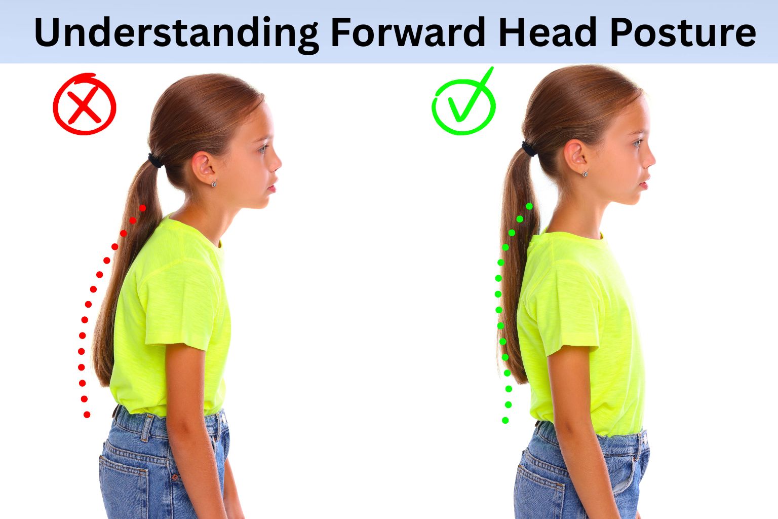 Chin Tucks for Forward Head Posture
